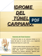 Sindrome Del Tunel Carpiano
