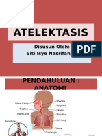 ATELEKTASIS