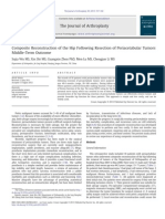 Composite Reconstruction of The Hip Following Resection of Periacetabular Tumors