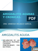 Amigdalitis Agudas y Cronicas