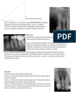 Diagnósticos RX dentales