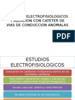 Estudios Electrofisiologicos y Ablacion Con Cateter de Vias