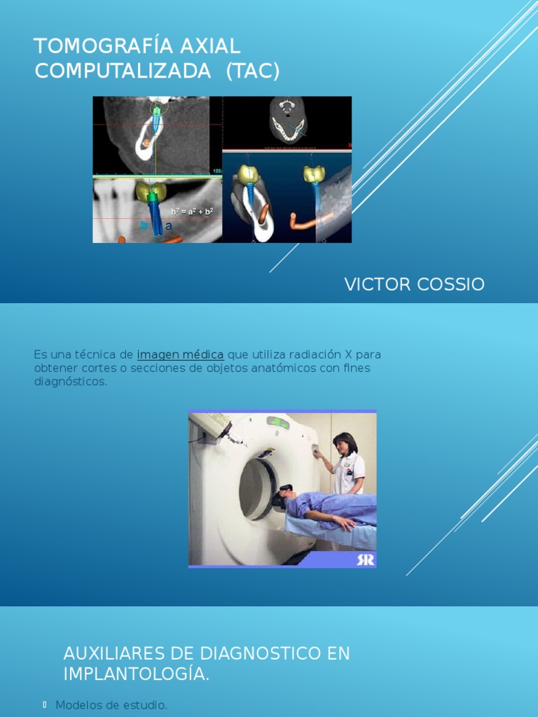 Tomografía Axial Computalizada (TAC) | PDF | Ct Scan | Ciencias de la Salud