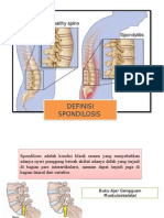 Definisi Dan Etiologi Spondilitis Pipit