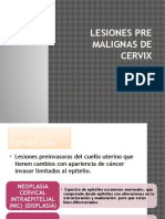 Lesiones Pre Malignas de Cervix