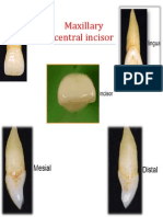 1-maxillary central incisor.pdf