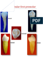 7-Man First Premolar