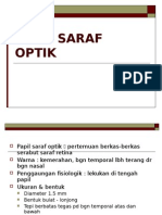 Neuritis Optik