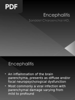 Encephalitis