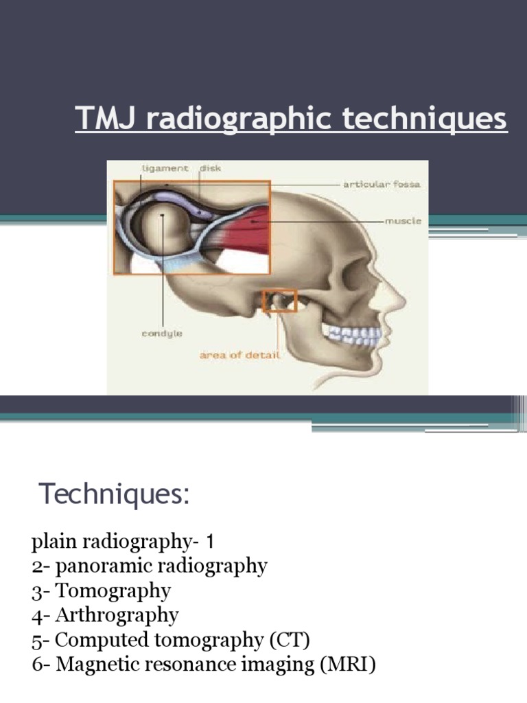TMJ Radiographic Examination Techniques | PDF | Ct Scan | Medical Imaging