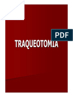 Traqueotomia Sap
