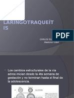 LARINGOTRAQUEÍTIS