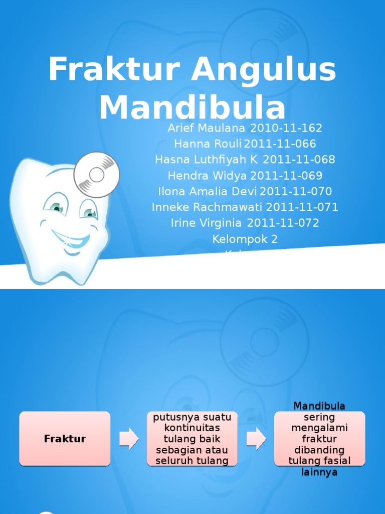 Fraktur Mandibula | PDF