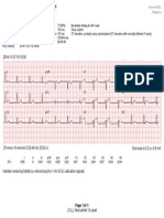 Validate Rendering Fidelity by Referencing The 1 MV ECG Calibration Signals
