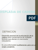 Displacia de Caderas