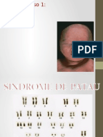 sindromes_geneticos