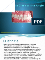 Malocluzia Clasa III Angle