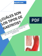 Los Tipos de Gastritis