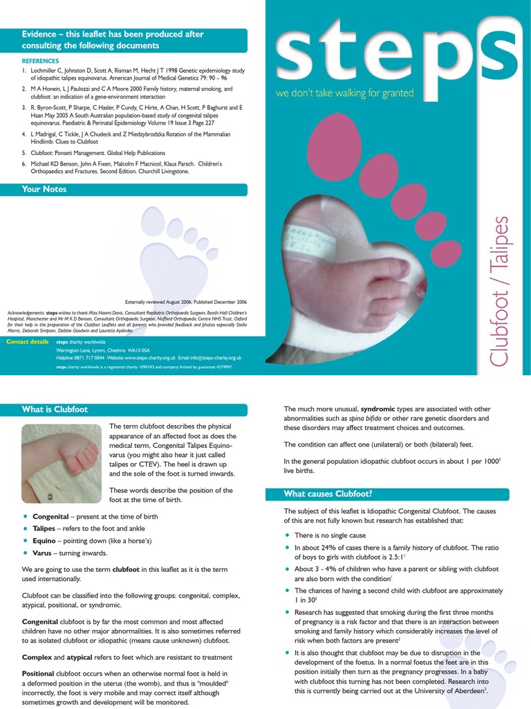Clubfoot Talipes Foot Clinical Medicine