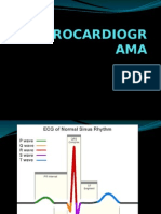 Ekg 1