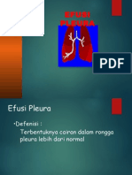 Efusi Pleura