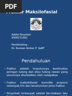 Download PPT Referat Fraktur Maksilofasial by Indra Fakhreza SN261266051 doc pdf