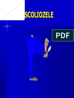 87025587-Scoliozele