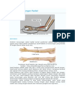 Sindrom Terowongan Radial