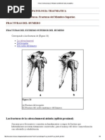 Fracturas Del Extremo Superior Del Humero