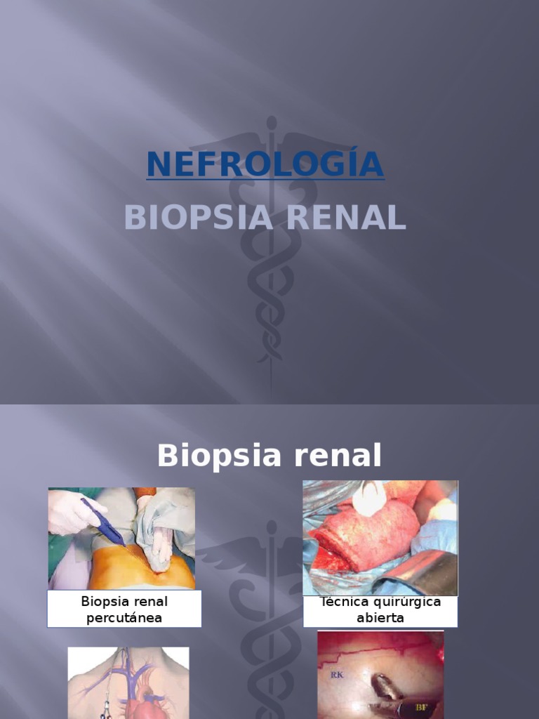 Biopsia Renal | PDF | Riñón | Nefrología