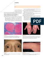 Cirrhosis Diagnosis and Treatment