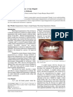 Gingival Depigmentation a Case Report
