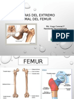 FX - Femur Proximal