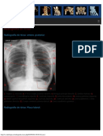 Radiografía de Tórax