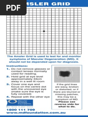 Amsler Grid