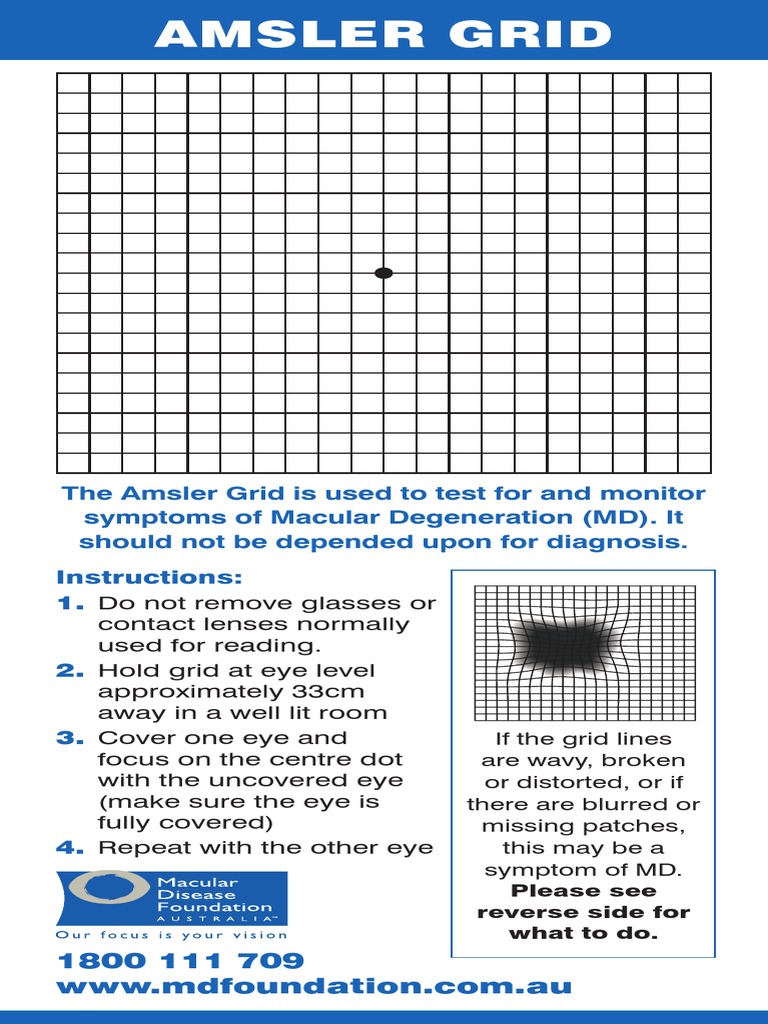 Amsler Grid Test for Macular Degeneration | PDF
