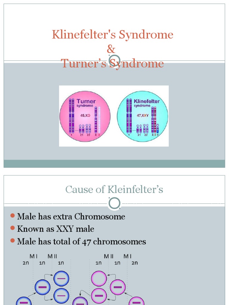 Klinefelter's Syndrome & Turner's Syndrome PDF Special Education