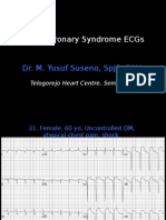 Acute Coronary Syndrome Ecgs: Dr. M. Yusuf Suseno, SPJP, Fiha