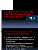 Clasificacion de Los Arcos Parcialmente Desdentados