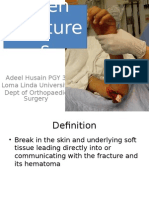 Open Fracture Classification and Treatment