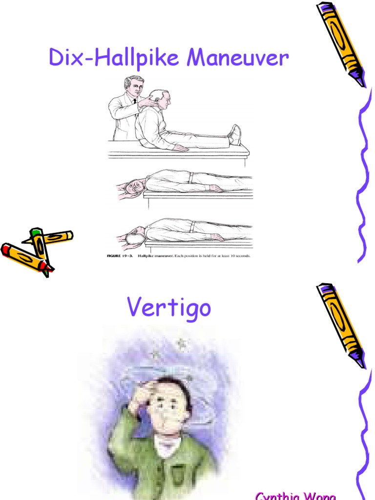 Approach to Diagnosing Vertigo | PDF | Vertigo | Otology