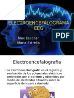 EEG guía completa