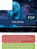Epilepsia en Pediatria