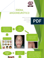 Edema Angioneurótico