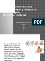 Enfermedad Diverticular y Cancer 