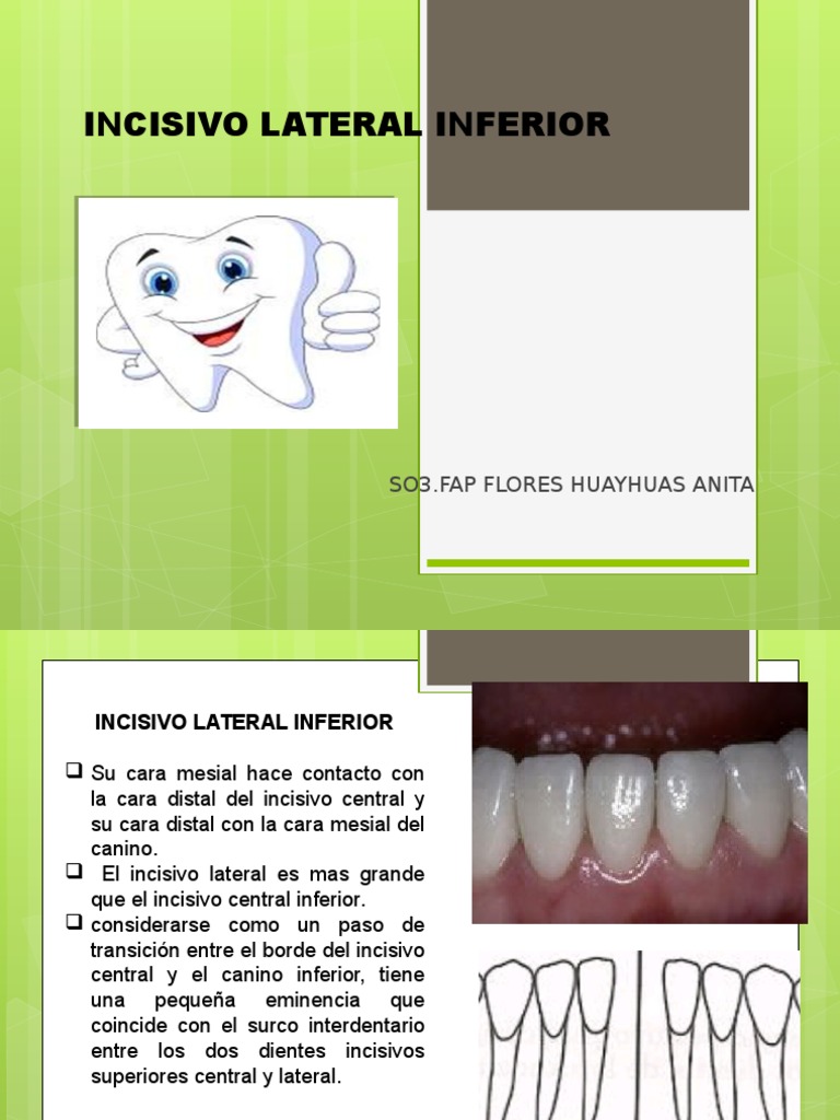 Incisivo Lateral Inferior | Ramas de Odontología | Anatomia dental