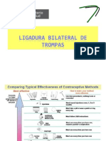 LIGADURA TROMPAS