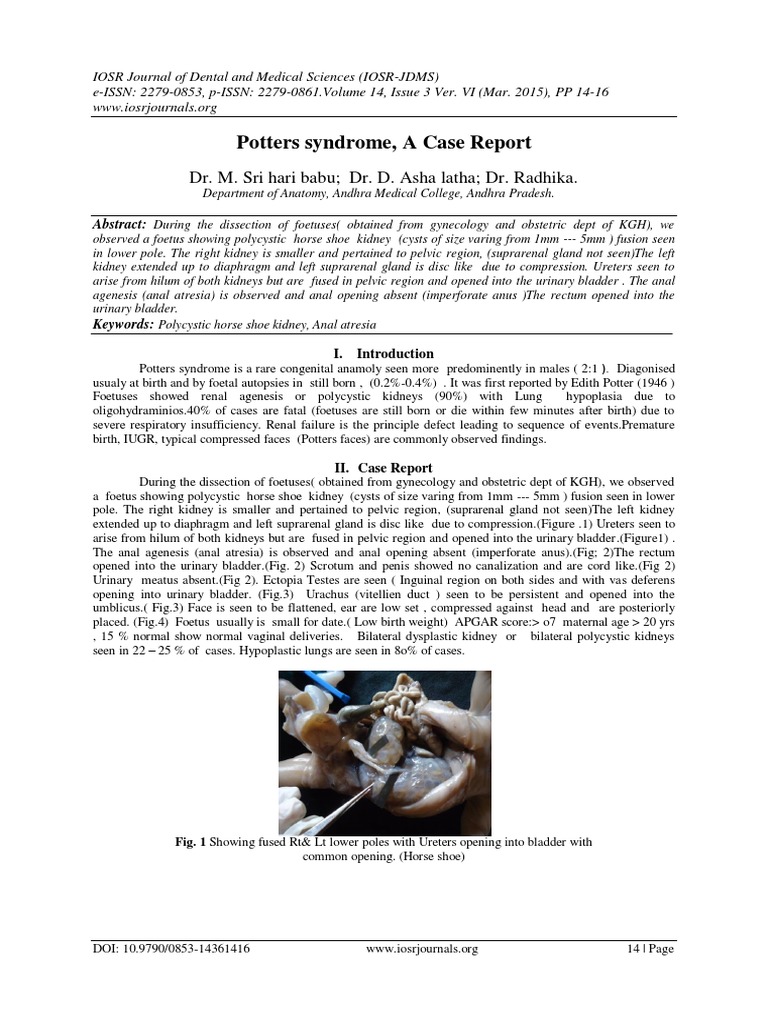 Potters Syndrome, A Case Report PDF Congenital Disorder Kidney