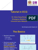 ECG tutorial covers basics, axis, waves, intervals, hypertrophy and more