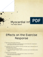 Myocardial Infarction